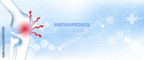Medical orthopedic and the future of the smart hospital. Treatment for orthopedics traumatology of knee bones and joints injury. Medical presentation, hospital. Vector illustration