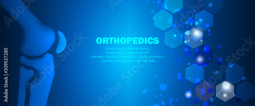 Medical orthopedic and the future of the smart hospital. Treatment for orthopedics traumatology of knee bones and joints injury. Medical presentation, hospital. Vector illustration
