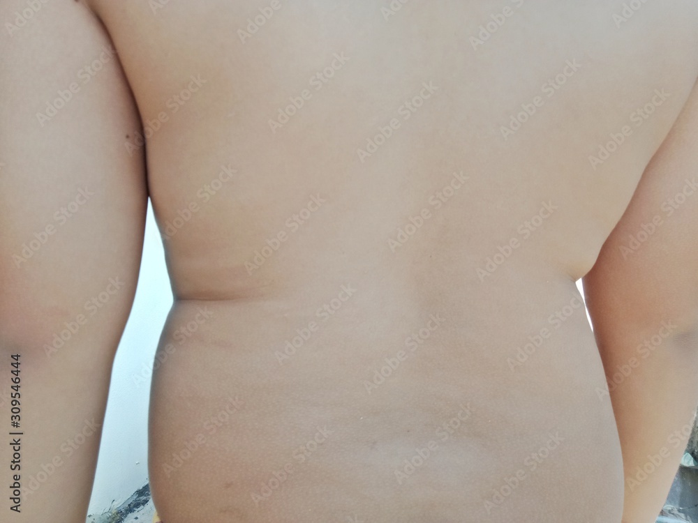 The physical condition of obese children The physical condition of obese children