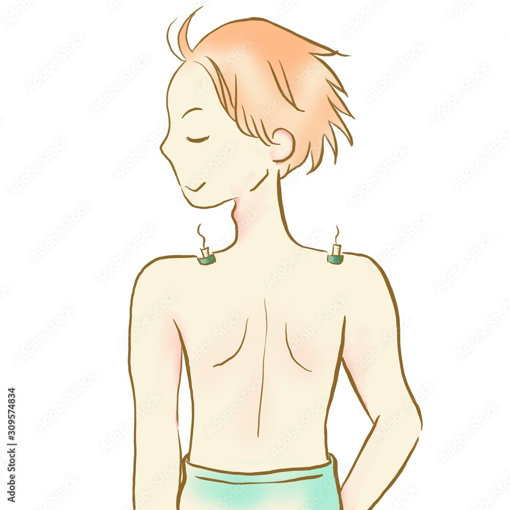 Man receiving moxibustion treatment5., alternative medicine Man receiving moxibustion treatment5., alternative medicine