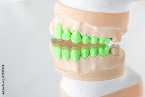 Close-up on plaster model of artificial jaw with teeth painted in green on the mirror background. Concept of aesthetic dentistry and implantation