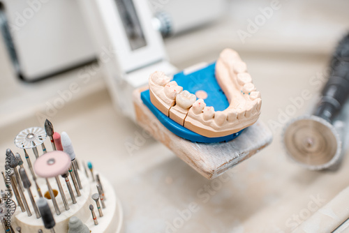 Artificial jaw for implants modeling with set of dental burs at the working place of dental technician in the laboratory