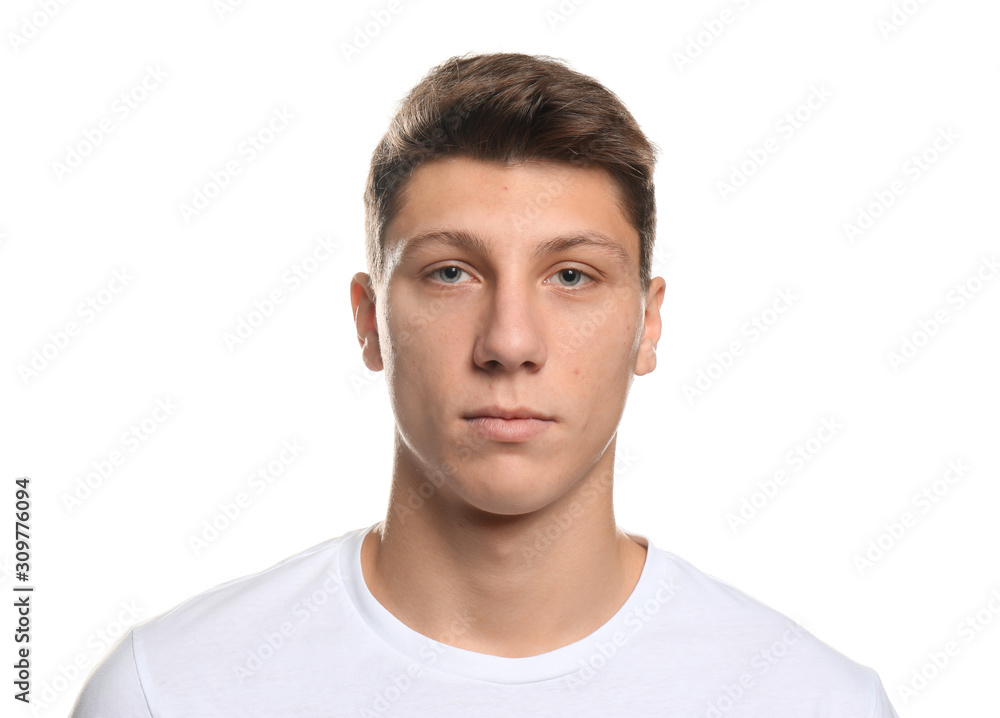 Teen guy with acne problem on white background Teen guy with acne problem on white background