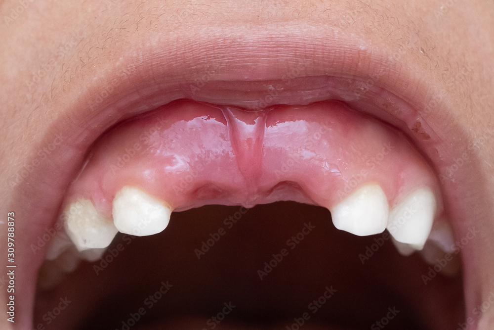 Obraz premium how to care for baby teeth, the concept of orthodontics and odontoriatrics