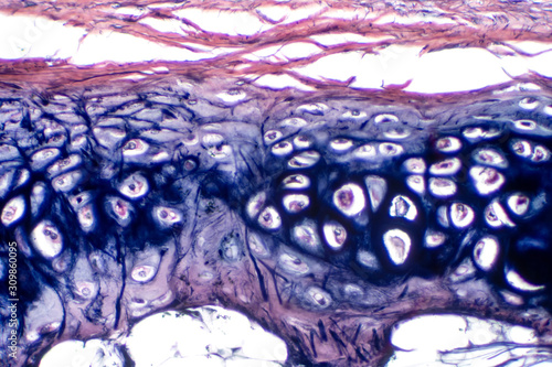 Human hyaline cartilage bone under microscope view for education pathology. photo