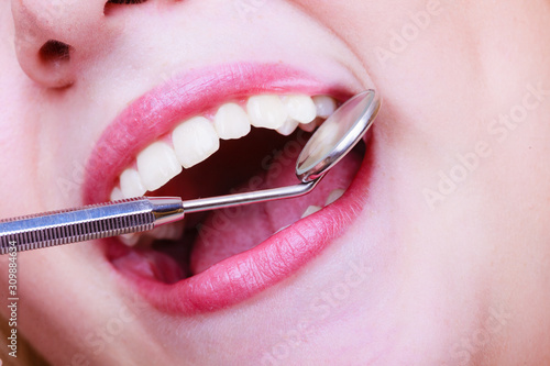 Woman teeth and dentist mouth mirror