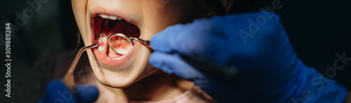 Close up of a girl mouth having a tooth examination by a pediatric stomatologist in pediatric dentistry. photo