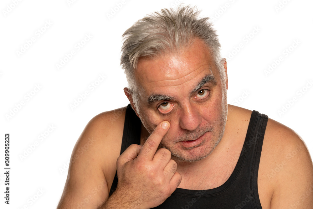 Obraz premium middle aged man pilling his lower eyelid on white background