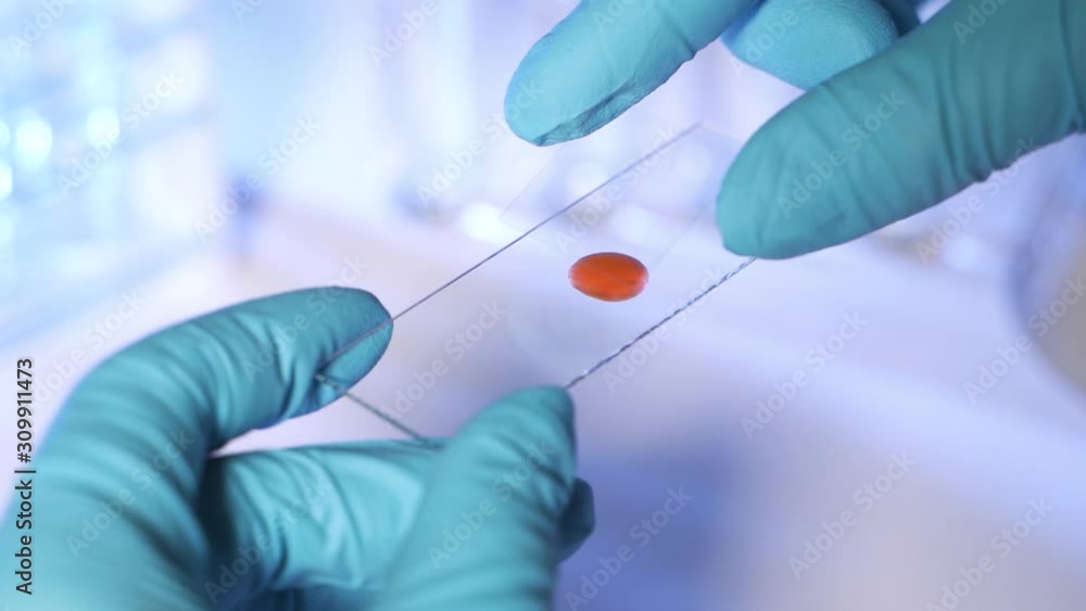 Lab technician holding pipette and testing blood samples on hospital ward for blood transfusion, hands close up Lab technician holding pipette and testing blood samples on hospital ward for blood transfusion, hands close up