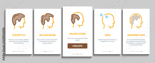 Hair Transplantation Onboarding Mobile App Page Screen. Balding And Baldness Man Head, Shampoo And Medicine In Bottle Transplantation Concept Illustrations