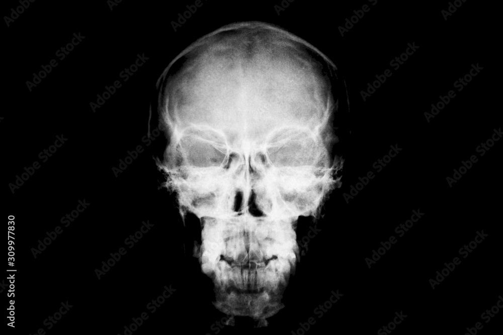 X-ray of head / Many others X-ray images in my portfolio. X-ray of head / Many others X-ray images in my portfolio.