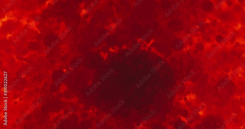 Small red blood cells in fluid Small red blood cells in fluid