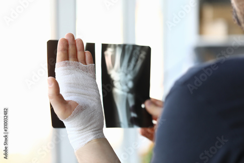 Fototapeta Male bandaged hand holds xray image closeup