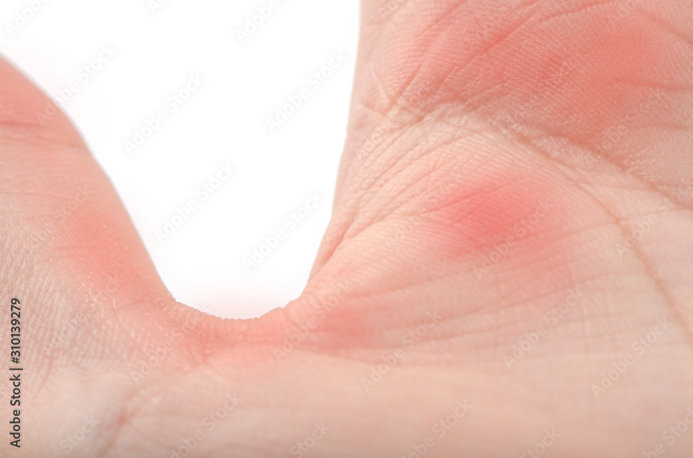 Painful hand by offfice syndome on white background. Painful hand by offfice syndome on white background.