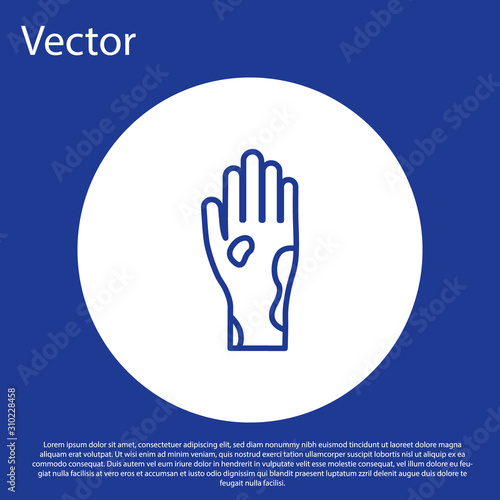 Blue line Hand with psoriasis or eczema icon isolated on blue background. Concept of human skin response to allergen or chronic body problem. White circle button. Vector Illustration