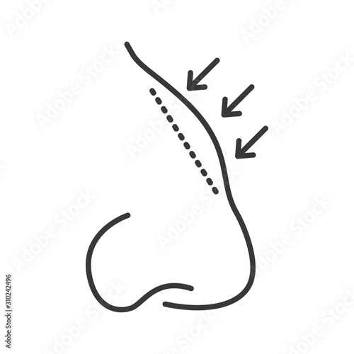 Rhinoplasty black line icon. Nose shape change plastic surgery. Cosmetology, skin care. Sign for web page, mobile app, banner, social media. Editable stroke.