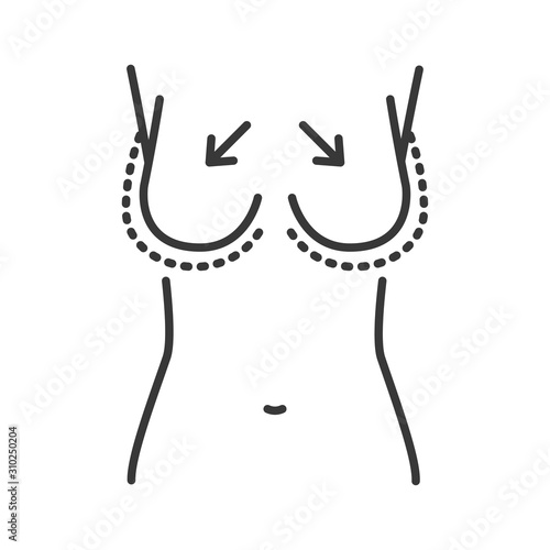 Female breast augmentation black line icon. Plastic body surgery. Sign for web page, mobile app, banner, social media. Editable stroke.