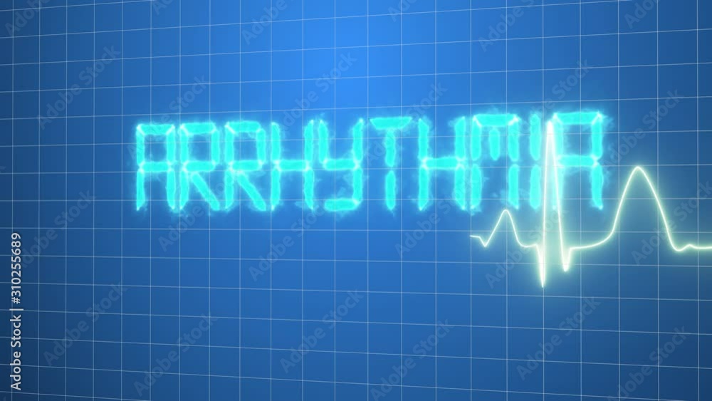 Warning, abnormal rhythm text on cardiogram wave, disease prevention gadgets. Patient's heart rate monitored, healthcare, disease prediction, prevention animation Warning, abnormal rhythm text on cardiogram wave, disease prevention gadgets. Patient's heart rate monitored, healthcare, disease prediction, prevention animation