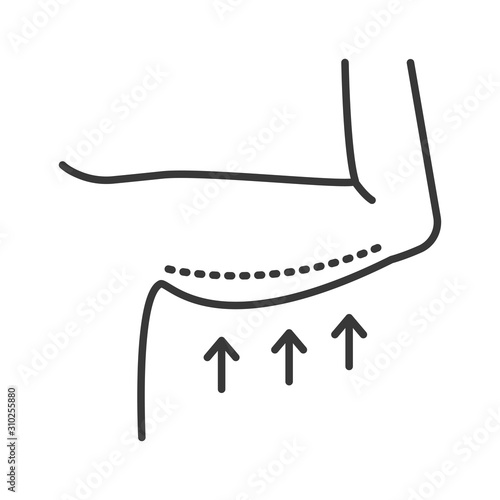 Brachioplasty black line icon. Arm lift concept. Plastic body surgery. Sign for web page, mobile app, banner, social media. Editable stroke.