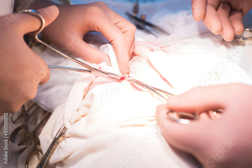 hands of surgeon and assistant close-up during operation