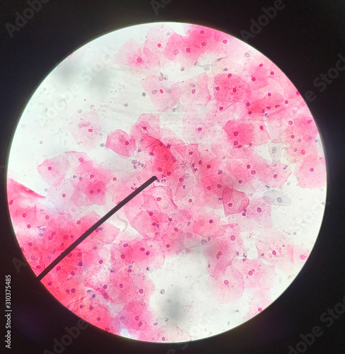 Fotografie Cells in reproductive female cytology and histology concept.