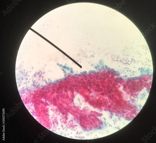 Cells in reproductive female cytology and histology concept.