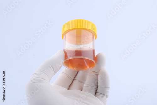 Hand hold bottles of urine test sample