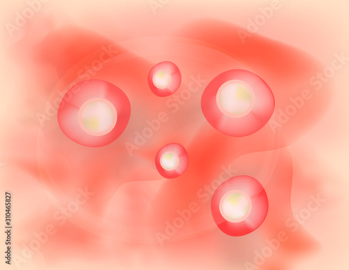 Pustules on the skin. Acne. Pimples on the skin background. Acne on the skin texture. Infographics. Vector illustration.