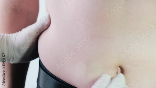 doctor performs palpation of the abdominal organs of the patient, close-up photo