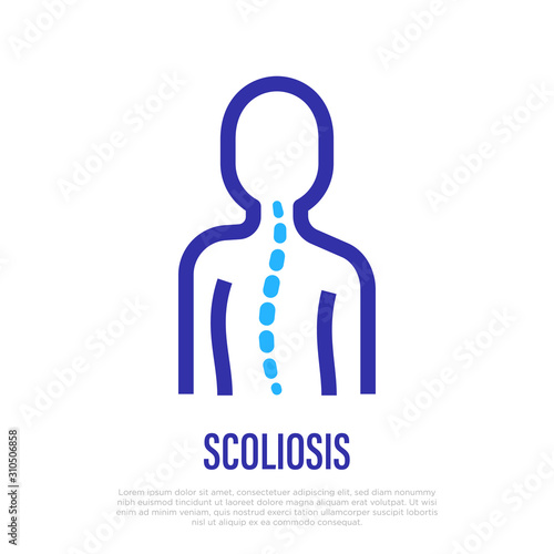 Scoliosis thin line icon. Vector illustration of back curvature.