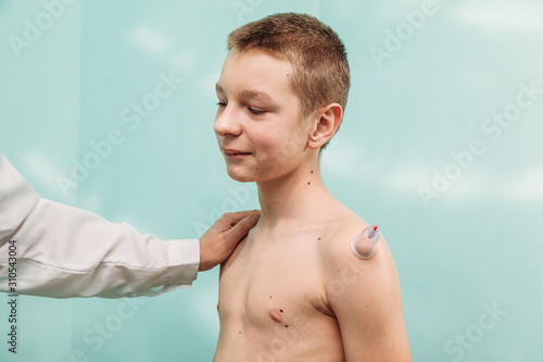 healing bloodletting hijama or phlebotomy hajam master conducts cupping therapy on a young man