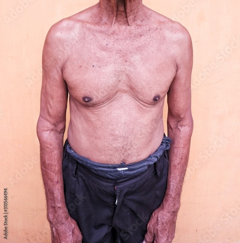 Bilde på lerret old man body shape on yellow background
