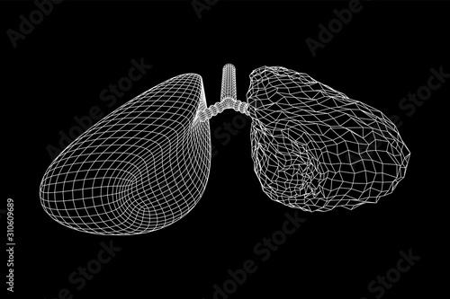 Healthy and sick lung with trachea bronchi internal organ human. Pulmonology medicine science technology concept. Wireframe low poly mesh vector illustration