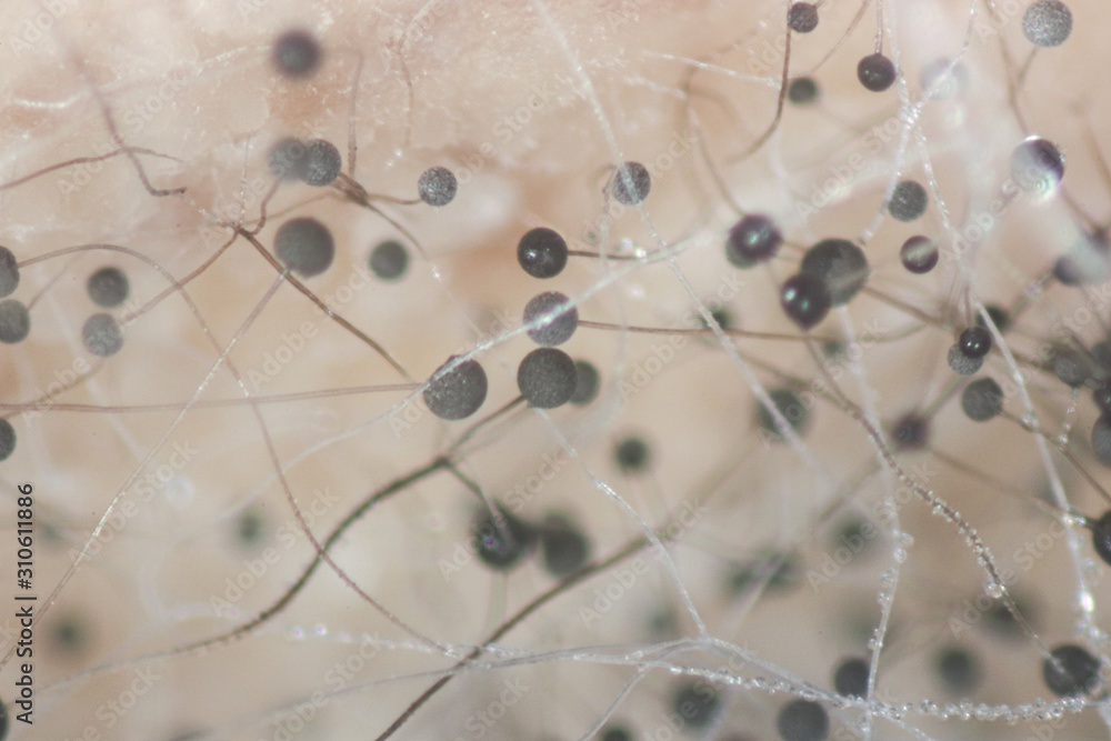 Yeast Microscope Bread