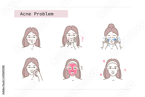 Beauty Girl Have Acne Skin Problems. Woman Making Hygienic Procedures against Acne. Before And After Results. Cleanser, Facial Mask for Unhealthy Skin. Flat Vector Illustration and Icons set.