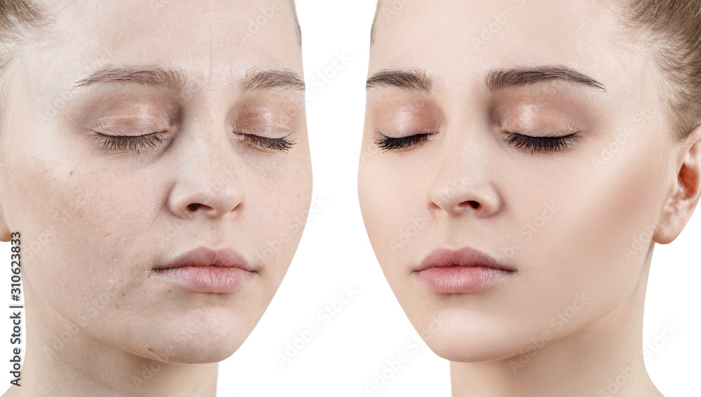 Comparison portrait of young woman with and without makeup. Comparison portrait of young woman with and without makeup.
