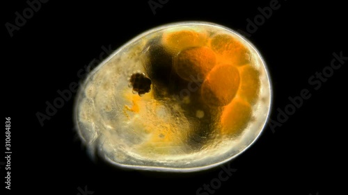 Ostracoda under a microscope, of the Cypridinidae family, in the video is a female with eggs, this family also includes the genus Vargula, whose males emit bioluminescent light to attract females photo