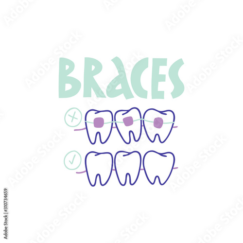 Dental braces - lingual braces, before and after. Hand-drawn illustration.