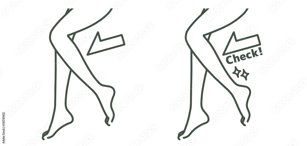 Fototapeta premium スリムな脚-ふくらはぎ-チェック