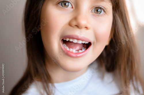 Beautiful smiling preschool girl with her first adult incisor tooth. Cute child showing her baby milk tooth fell out and her growing permanent tooth in open mouth. Dental hygiene concept