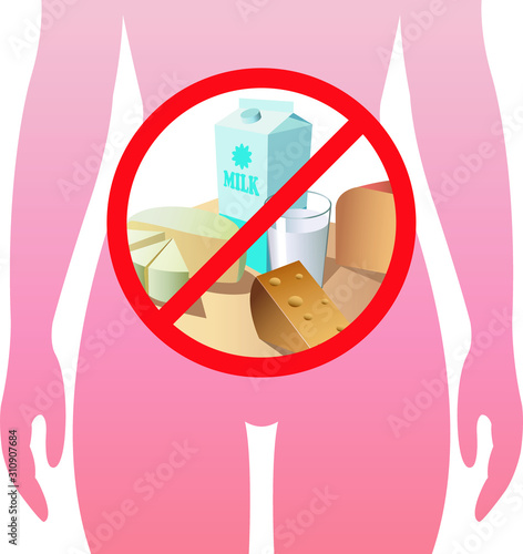 A medical illustration of lactose intolerance with the products which cause this allergy.
