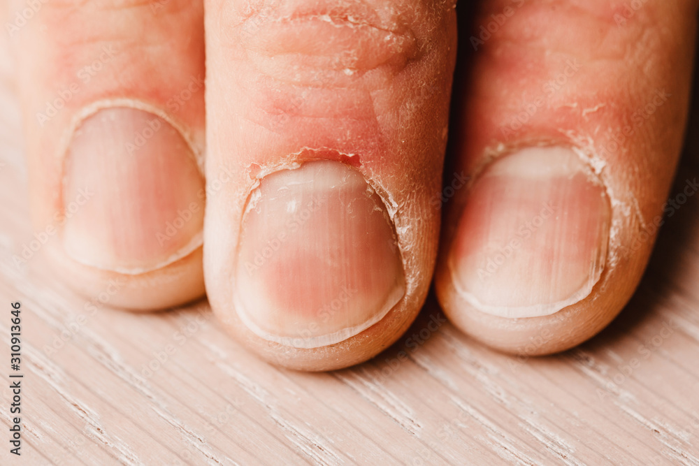 Fingers with groomed nails and cuticles - manicure required Fingers with groomed nails and cuticles - manicure required