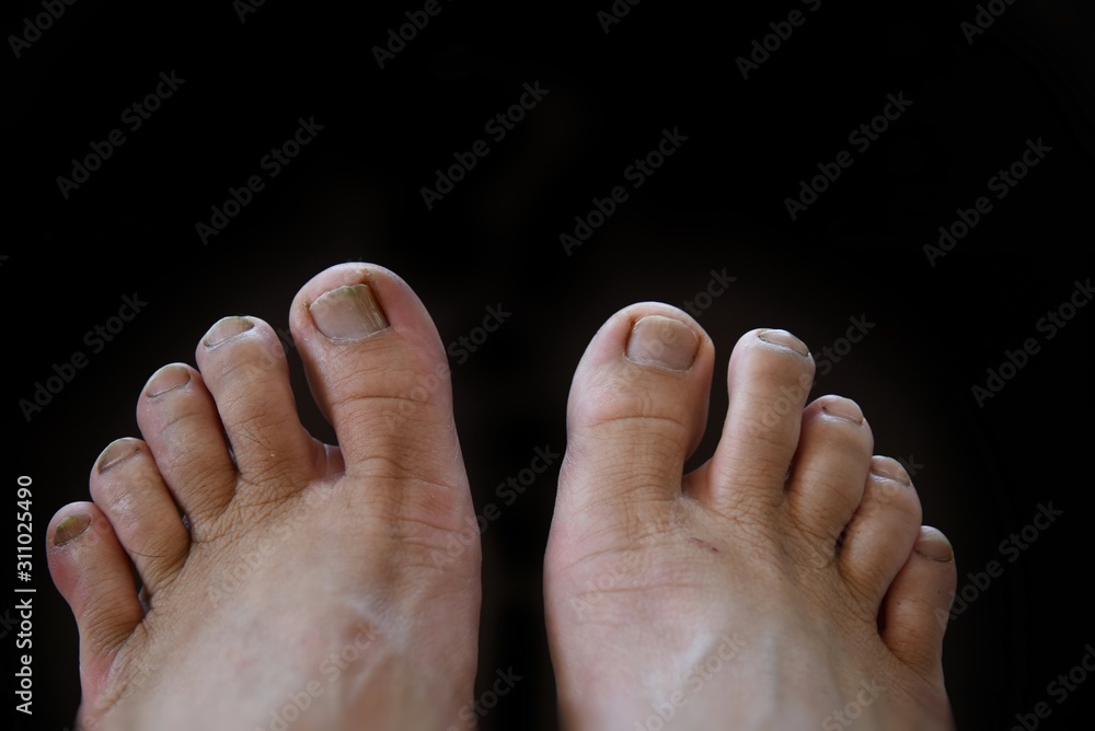 Fototapeta premium dirty old feet on black background
