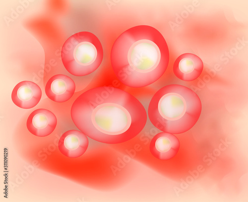 Pustules on the skin. Cystic acne. Pimples on the skin background. Acne on the skin texture. Infographics. Vector illustration.