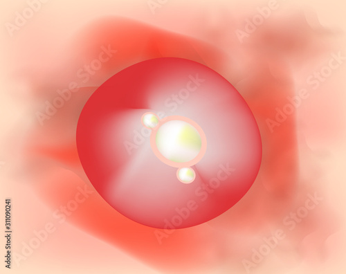 Pustules on the skin. Cystic acne. Pimples on the skin background. Furuncle. Acne on the skin texture. Infographics. Vector illustration.