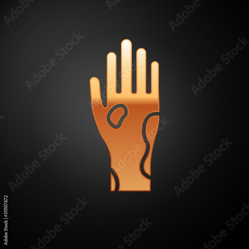 Gold Hand with psoriasis or eczema icon isolated on black background. Concept of human skin response to allergen or chronic body problem.  Vector Illustration