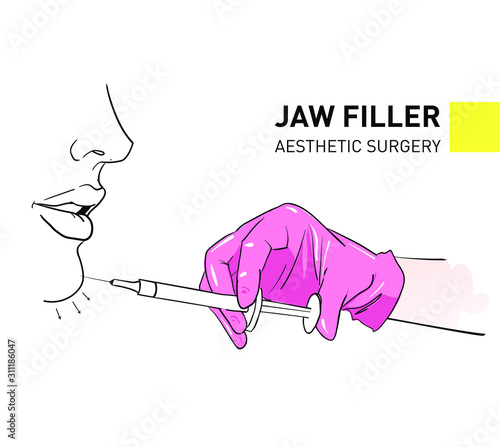 JAW filler plastic surgery and medical surgery	