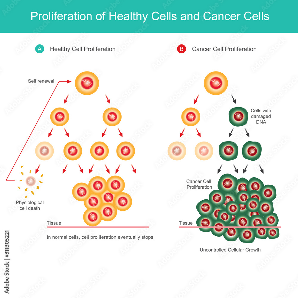 Vecteur Stock Proliferation Of Healthy Cells And Cancer Cells Comparison Illustration Of Normal