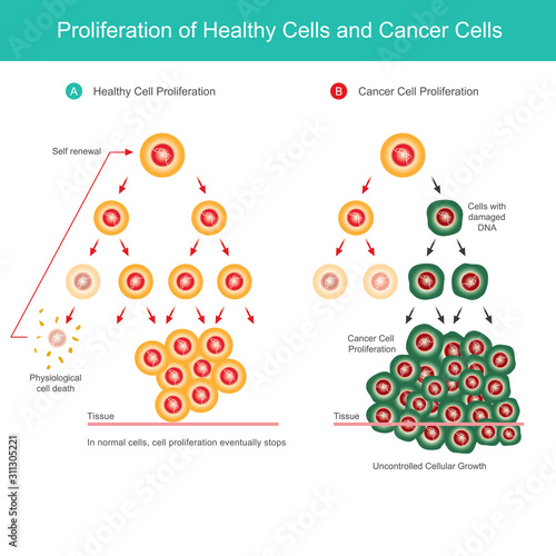 Proliferation of Healthy Cells and Cancer Cells. Comparison illustration of normal cell proliferation and Cancer cell proliferation in the body..