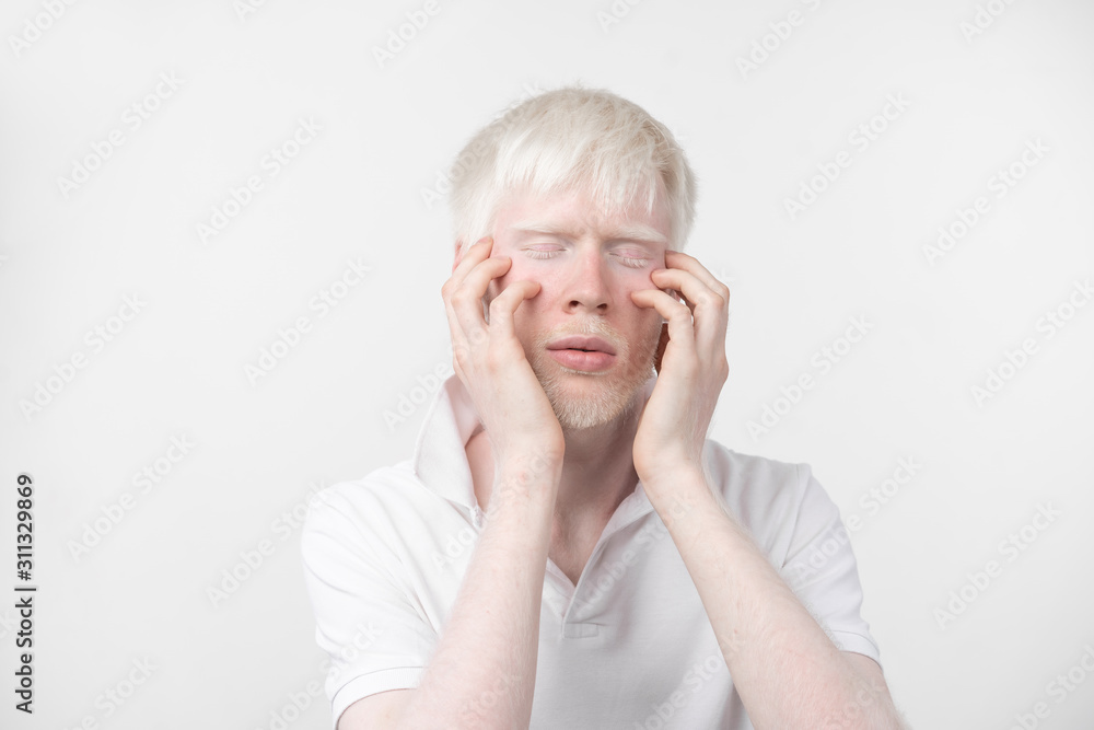 portrait of an albino man in studio dressed t-shirt isolated on a white background. abnormal deviations. unusual appearance portrait of an albino man in studio dressed t-shirt isolated on a white background. abnormal deviations. unusual appearance
